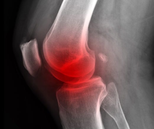 Moneyball for Health Care: Part 2